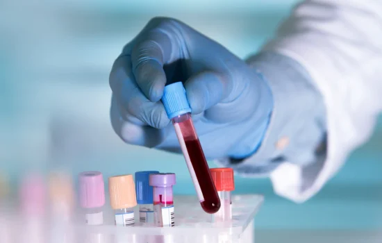 The Complete Blood Testing You Need!