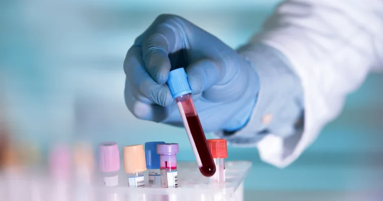 The Complete Blood Testing You Need!